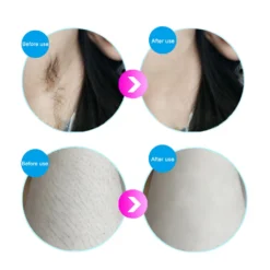 Haarentfernungsgeräte IPL Hautverjüngung Haarentferner Laserverjüngung Hair Remover Schönheitsinstrument Schmerzlos Mit Sonnenbrille -Smart Kitchen Store 3a83b54bd62ed75d3114d601c34abd7c