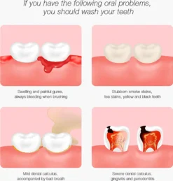 DR.BEI YC2 Ultraschall-Scaler IPX7 Wasserdichter Zahnsteinentferner Mit 3 Modi / LED-Zusatzscheinwerfer Tragbarer Wiederaufladbarer Zahnstein-Zahnsteinschaber Elektrischer Plaque-Entferner Zahnflecken-Reinigungswerkzeug Fuer Erwachsene 19 DR.BEI YC2 Ultraschall-Scaler IPX7 Wasserdichter Zahnsteinentferner Mit 3 Modi / LED-Zusatzscheinwerfer Tragbarer Wiederaufladbarer Zahnstein-Zahnsteinschaber Elektrischer Plaque-Entferner Zahnflecken-Reinigungswerkzeug Fuer Erwachsene -Smart Kitchen Store 7d68da43f50c1051c2b62c635b5e33c2