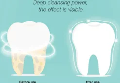 DR.BEI YC2 Ultraschall-Scaler IPX7 Wasserdichter Zahnsteinentferner Mit 3 Modi / LED-Zusatzscheinwerfer Tragbarer Wiederaufladbarer Zahnstein-Zahnsteinschaber Elektrischer Plaque-Entferner Zahnflecken-Reinigungswerkzeug Fuer Erwachsene 22 DR.BEI YC2 Ultraschall-Scaler IPX7 Wasserdichter Zahnsteinentferner Mit 3 Modi / LED-Zusatzscheinwerfer Tragbarer Wiederaufladbarer Zahnstein-Zahnsteinschaber Elektrischer Plaque-Entferner Zahnflecken-Reinigungswerkzeug Fuer Erwachsene -Smart Kitchen Store cf85986b892b2875c1359d4450d0bc9d