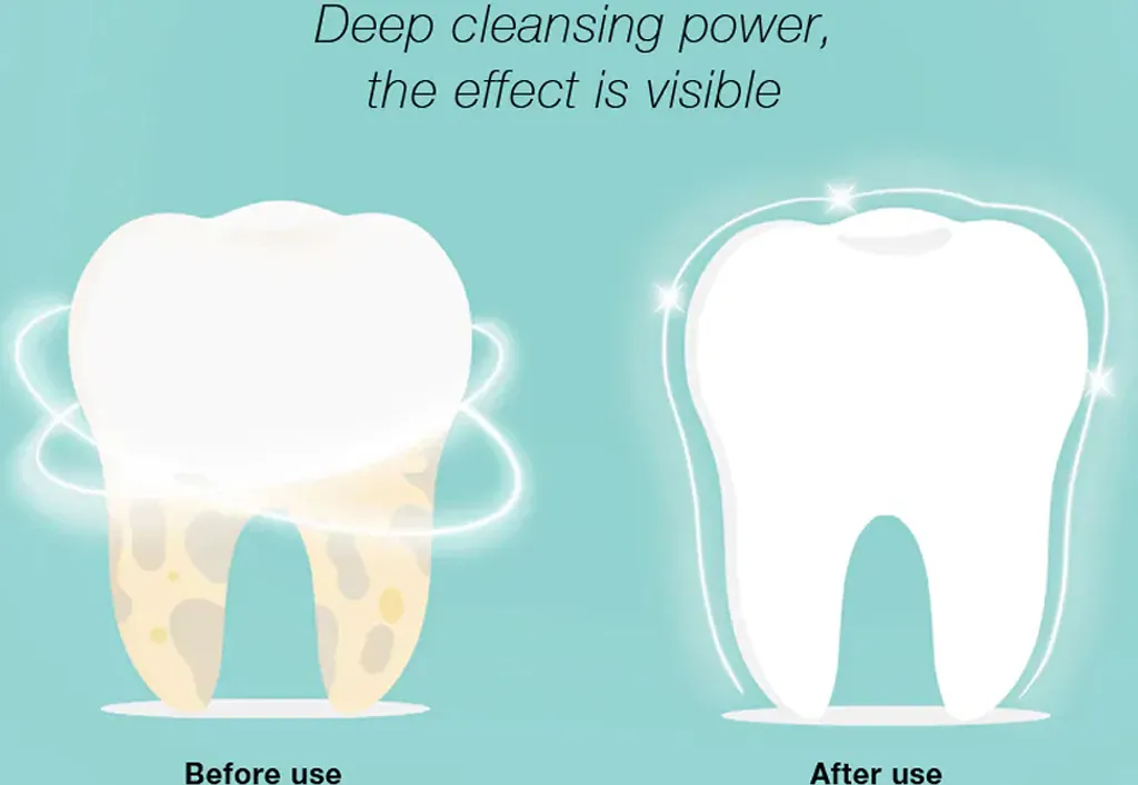 DR.BEI YC2 Ultraschall-Scaler IPX7 Wasserdichter Zahnsteinentferner Mit 3 Modi / LED-Zusatzscheinwerfer Tragbarer Wiederaufladbarer Zahnstein-Zahnsteinschaber Elektrischer Plaque-Entferner Zahnflecken-Reinigungswerkzeug Fuer Erwachsene 8 DR.BEI YC2 Ultraschall-Scaler IPX7 Wasserdichter Zahnsteinentferner Mit 3 Modi / LED-Zusatzscheinwerfer Tragbarer Wiederaufladbarer Zahnstein-Zahnsteinschaber Elektrischer Plaque-Entferner Zahnflecken-Reinigungswerkzeug Fuer Erwachsene – Bild 6