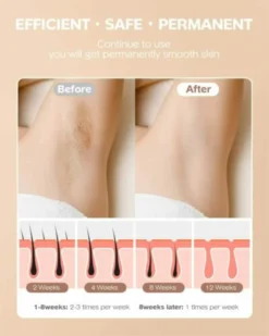 INNZA 999000 Impulse Laser Haarentfernung IPL Haarentfernungsgerät Laser HaarentfernungGeräte Dauerhafte Haarentfernung Für Körper Gesicht Schmerzlos Epilierer Körper Mit Schutzbrille -Smart Kitchen Store eb363e0d940802fc794538ee1be85a2d